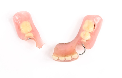 denture-repair